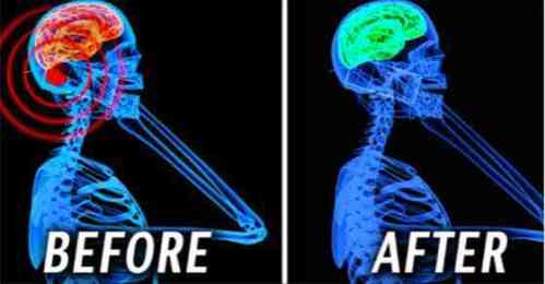 Cell phone Radiation
